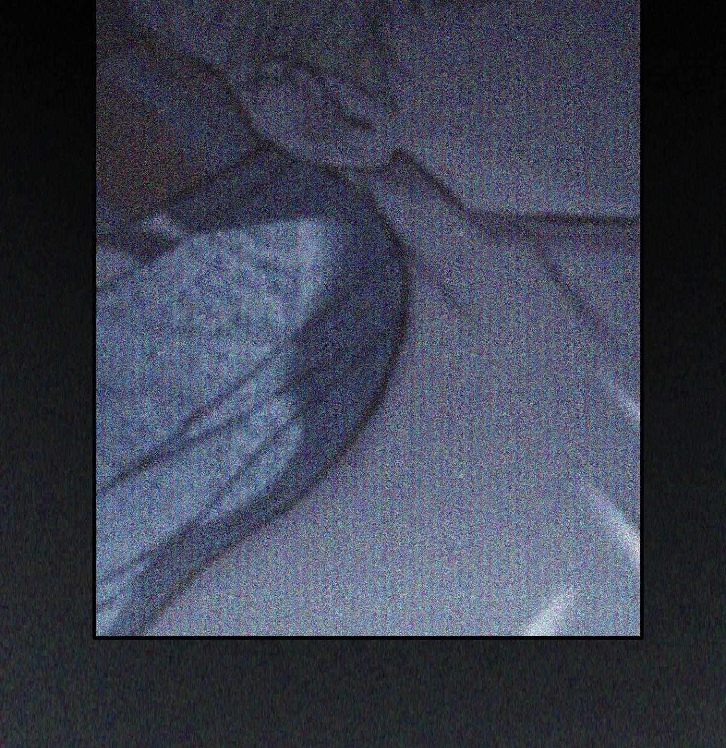 Read Flashlight Manga Online